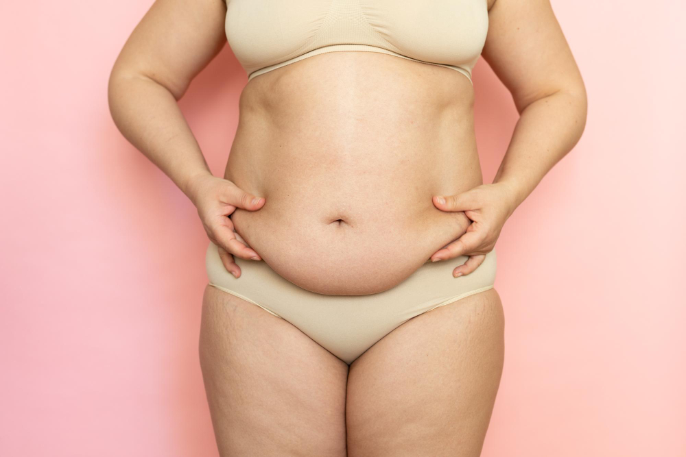 Modal showing Fleur-de-lis Tummy Tuck Surgery