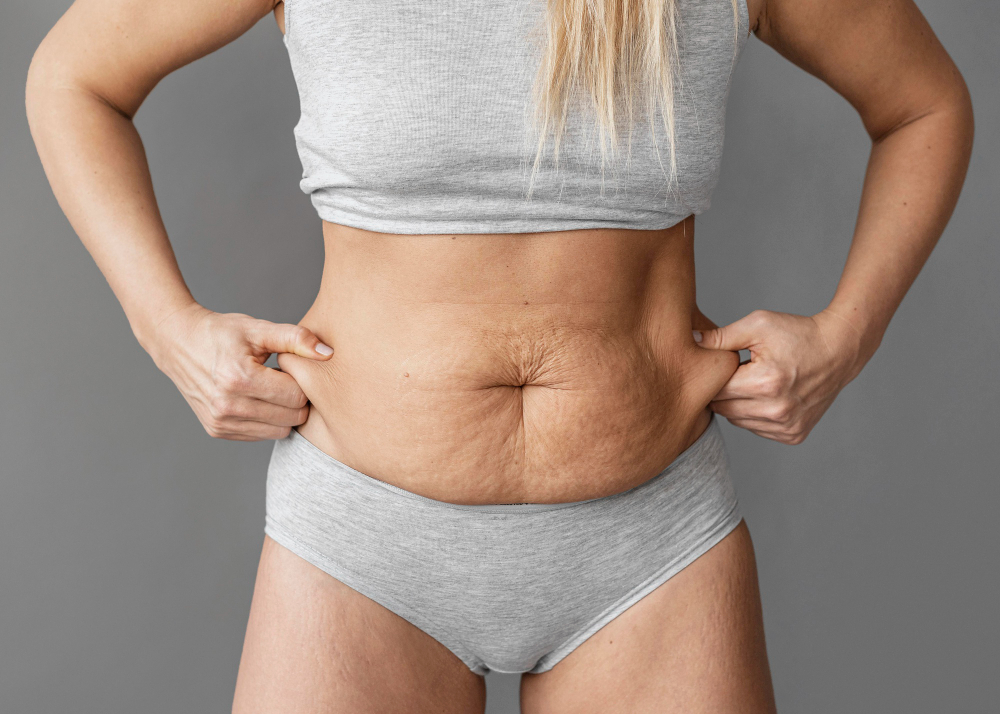 Modal showing Fleur-de-lis Tummy Tuck Surgery
