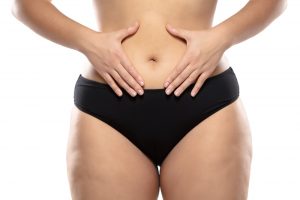 A Photo For A Blog Post About Does Your Belly Button Look Different After A Tummy Tuck