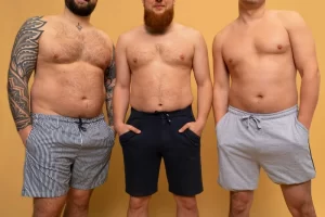 Can Gynecomastia Be Cured Without Surgery