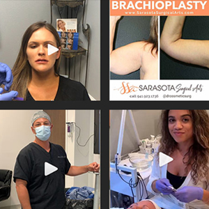 Discover Stunning Cosmetic Surgery Results by Sarasota's Top Plastic Surgeon on Instagram