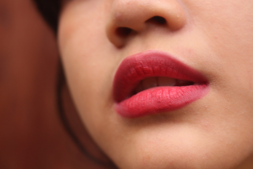 A Photo For A Blog Post About Are Lip Fillers Safe